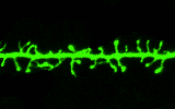 The image depicts a dendritic segment with spiny bulbed protrusions.